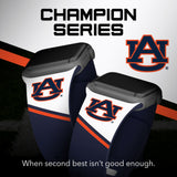 Auburn Tigers HD Apple Watch Band