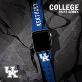 Kentucky Wildcats HD Apple Watch Band